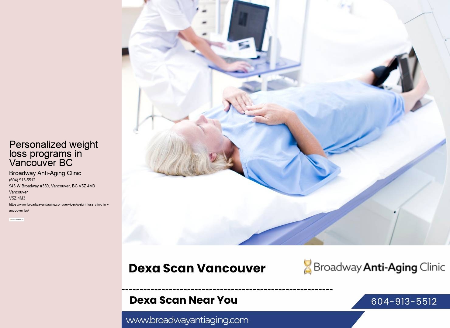 Expert weight management in Vancouver