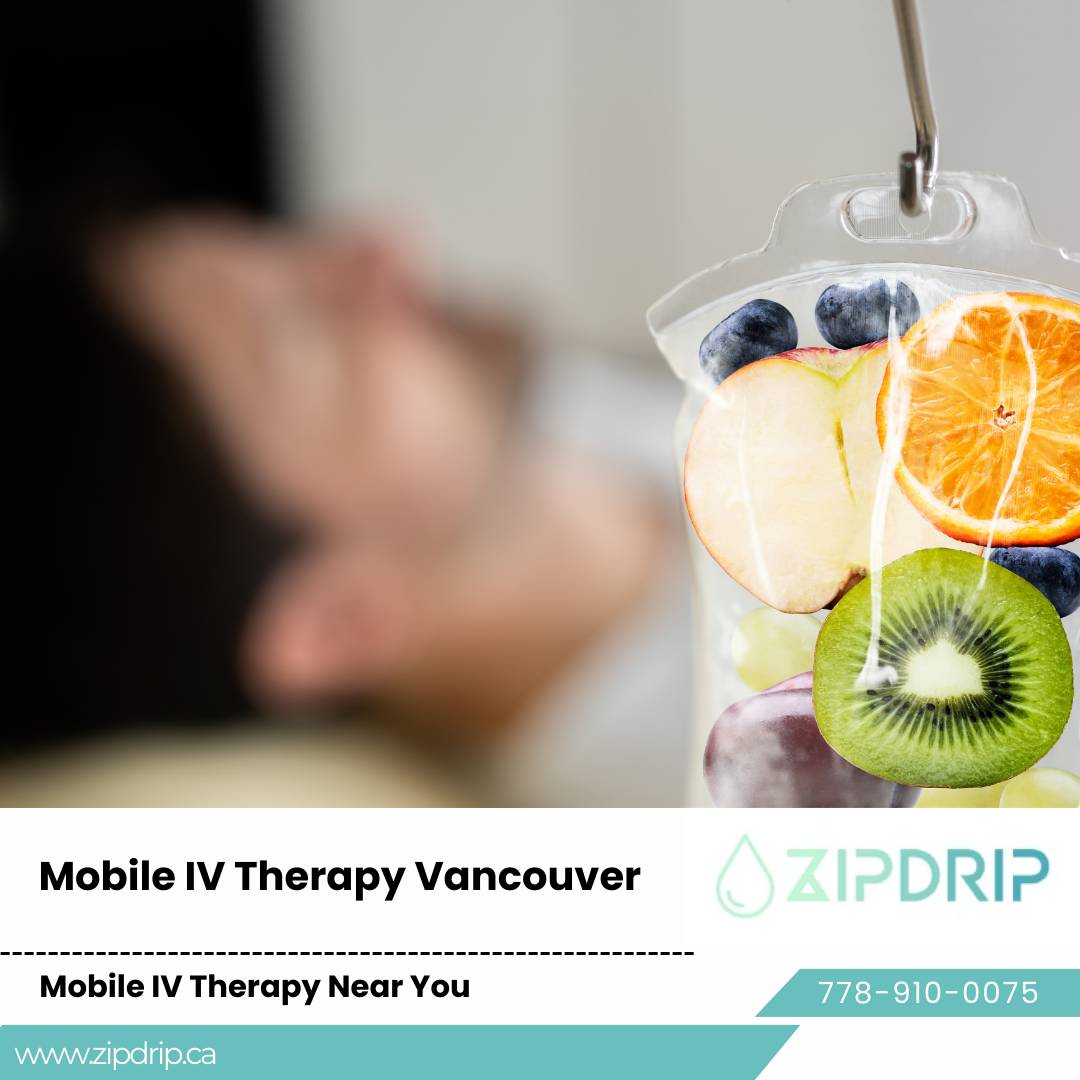 Mobile IV Vitamin Infusion IV hydration for events