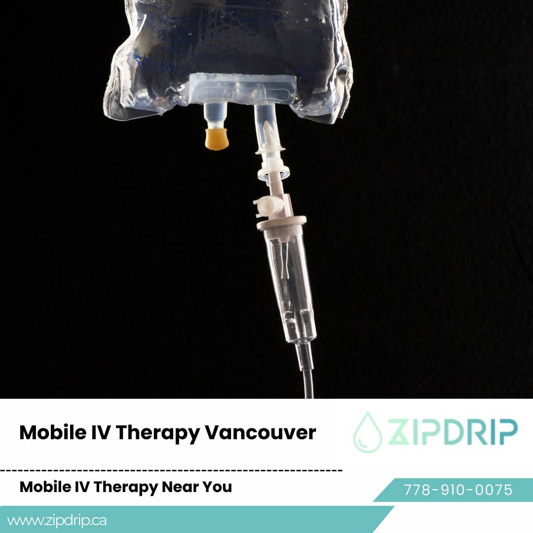 In-Home IV Drip Services Hydration therapy