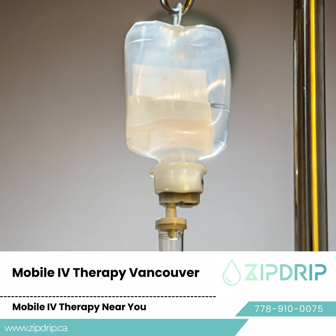 Mobile IV therapy for hangover cure Vancouver IV hydration at home