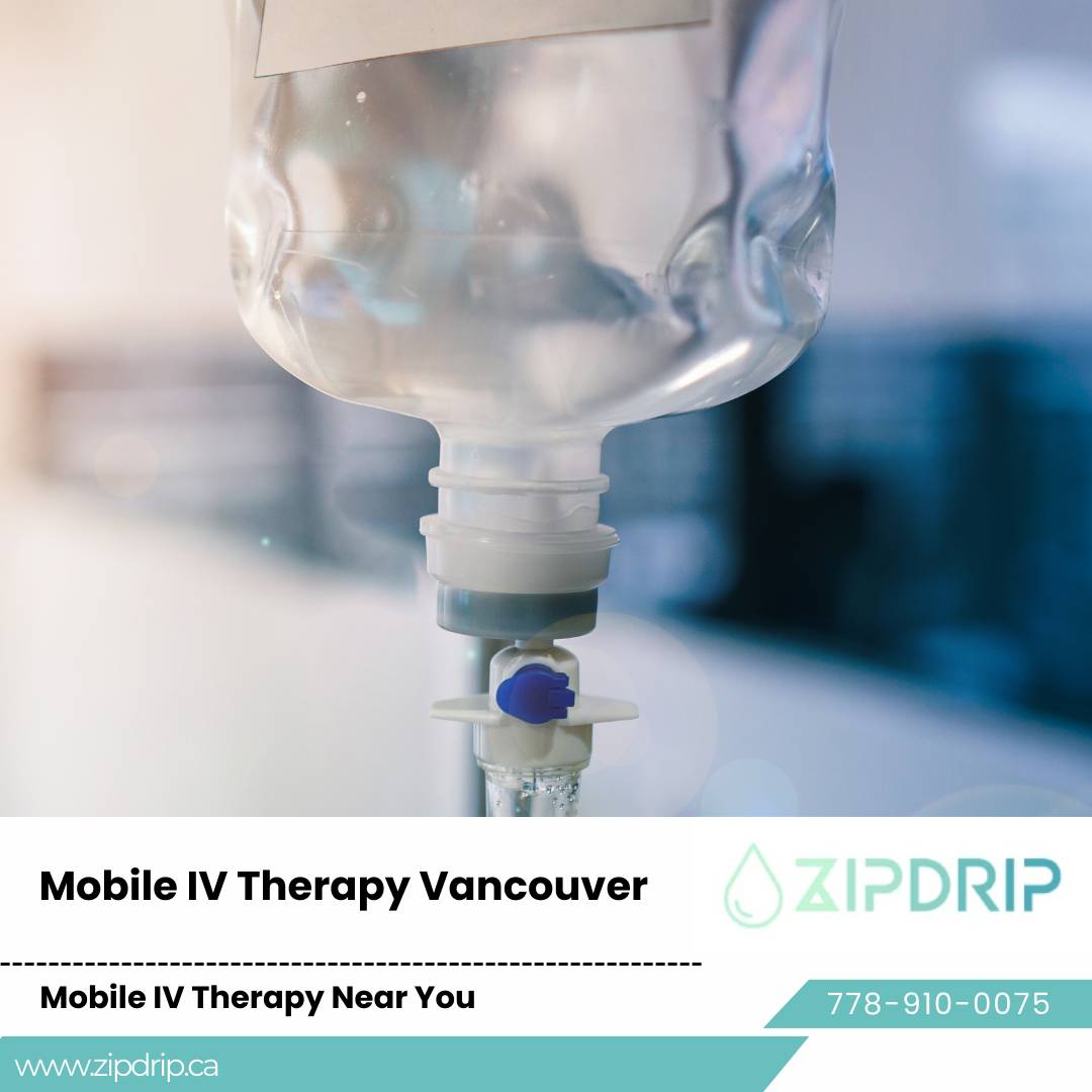 Mobile IV Therapy in Downtown IV drip for dehydration Vancouver