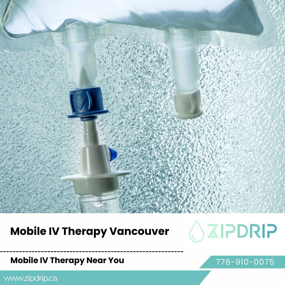 Quick Recovery Mobile IV Therapy IV Therapy for Dehydration Vancouver